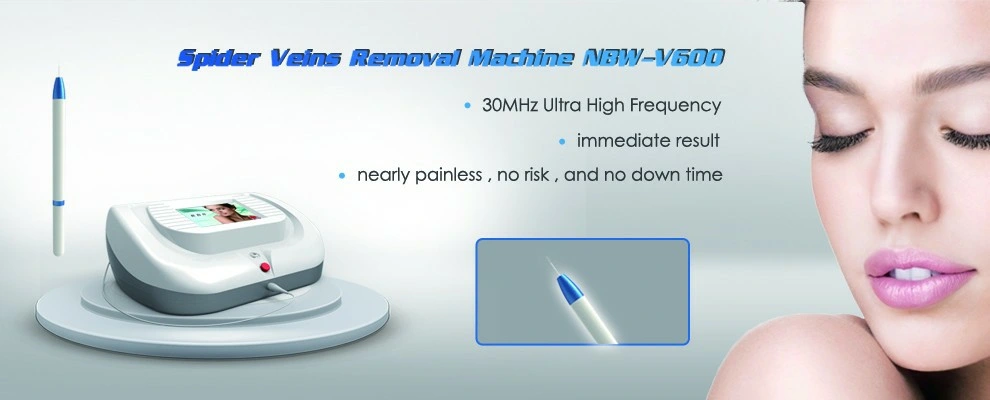 30MHz Rbs Vascular Surgical Vascular Spider Vein Removal Beauty Machine Acne Treatment Vascular Removal Rbs